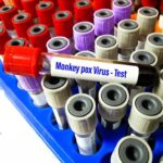 China Implements New Strategies to Combat Monkeypox Outbreak China Implements New Strategies to Combat Monkeypox Outbreak