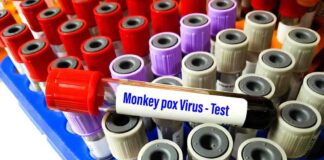 China Implements New Strategies to Combat Monkeypox Outbreak