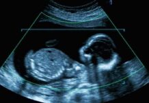 Born-Alive Law Draws a Clear Line Fetal ultrasound scan image